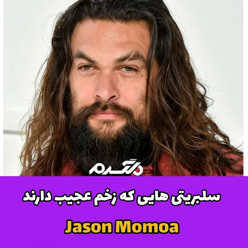 سلبریتی هایی که زخم عجیب دارند