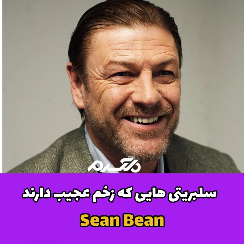 سلبریتی هایی که زخم عجیب دارند
