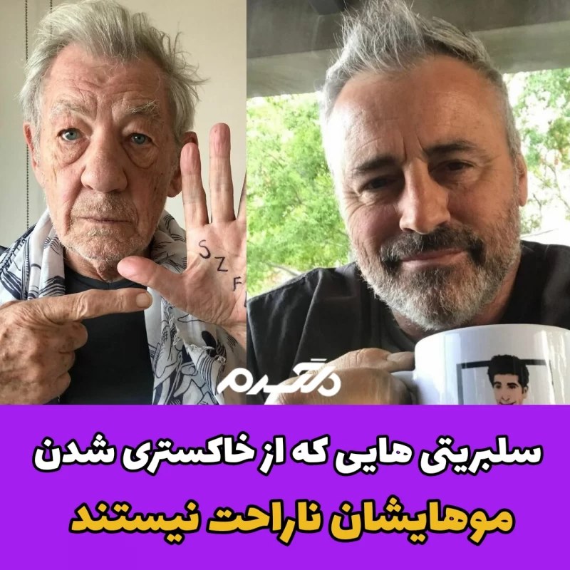 سلبریتی هایی که از خاکستری شدن موهایشان ناراحت نیستند!