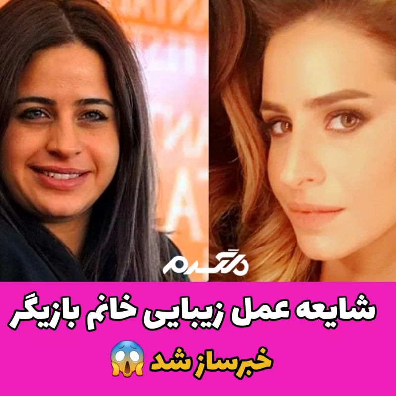 شایعه عمل زیبایی خانم بازیگر خبرساز شد