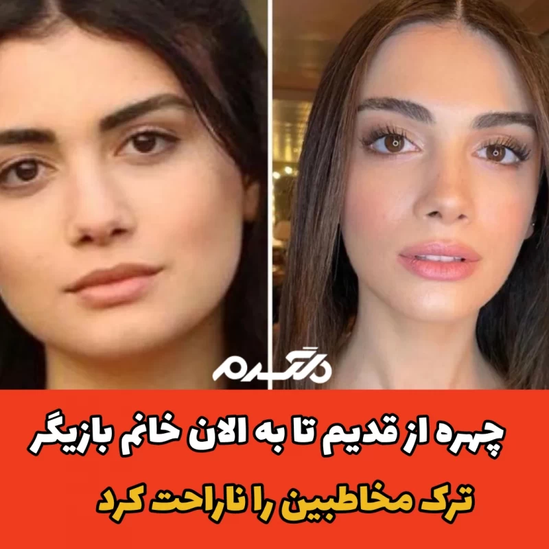 تعییر چهره از قدیم تا به الان خانم بازیگر ترک مخاطبین را ناراحت کرد