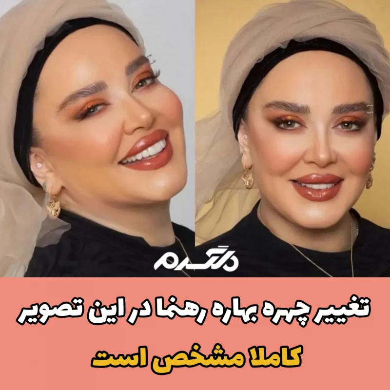 تغییر چهره بهاره رهنما در این تصویر کاملا مشخص است