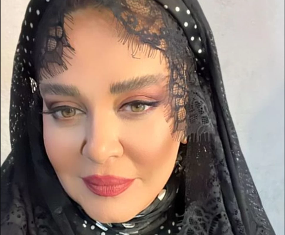 تغییر چهره بهاره رهنما در این تصویر کاملا مشخص است