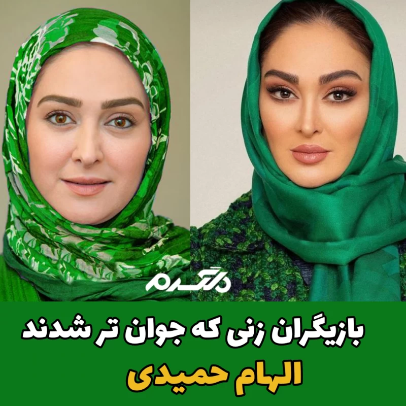 بازیگران زنی که جوان تر شدند