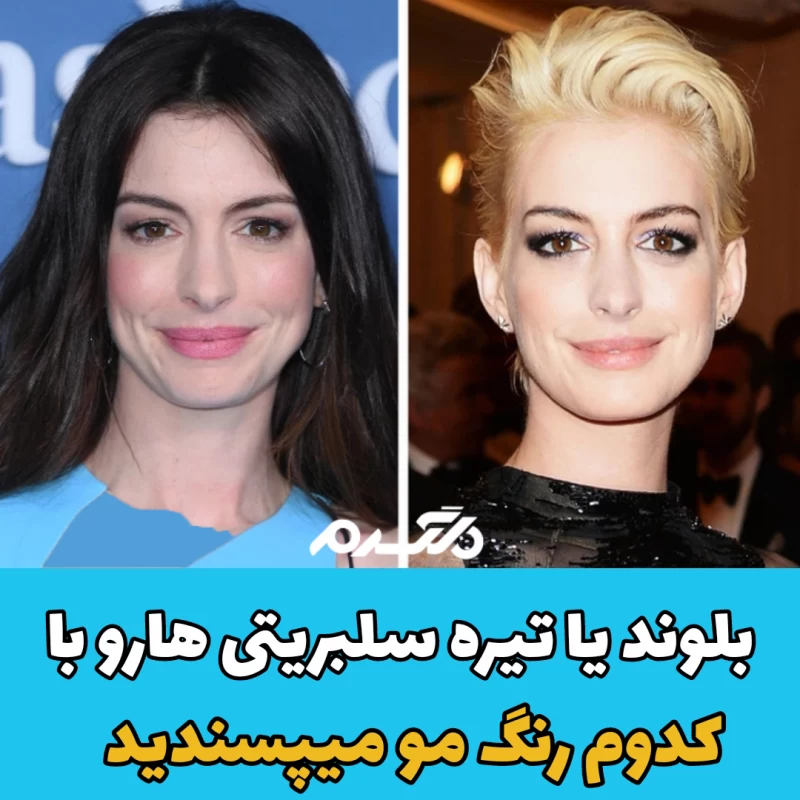 بلوند یا تیره، سلبریتی ها رو با کدوم رنگ مو می پسندید