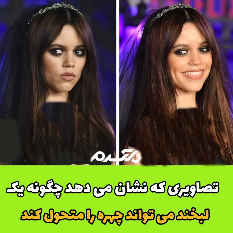 تصاویری که نشان می دهد چگونه یک لبخند می تواند چهره را متحول کند