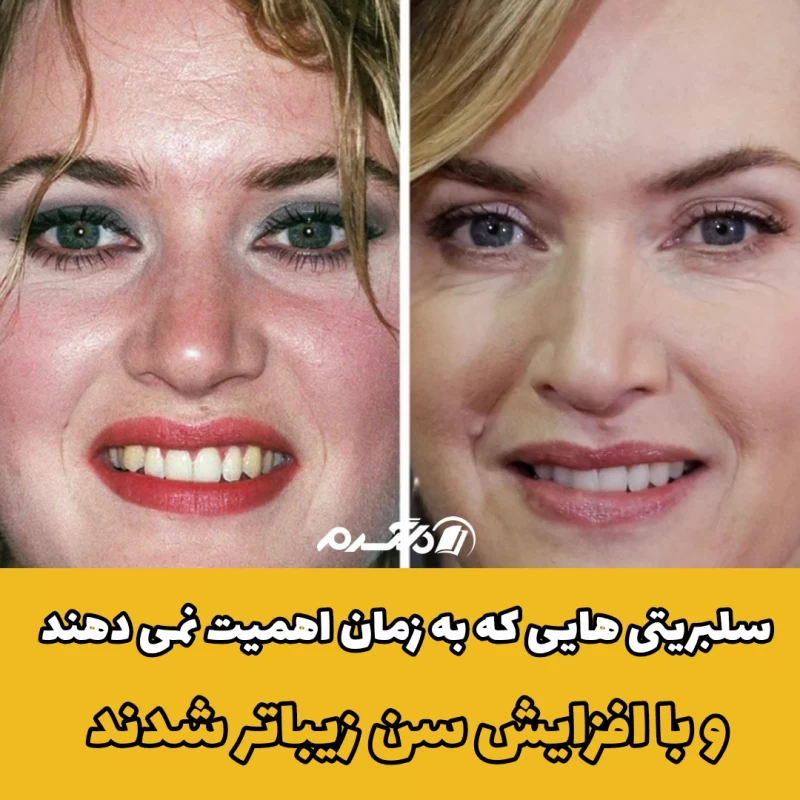 سلبریتی هایی که به زمان اهمیت نمی دهند و با افزایش سن زیباتر شدند
