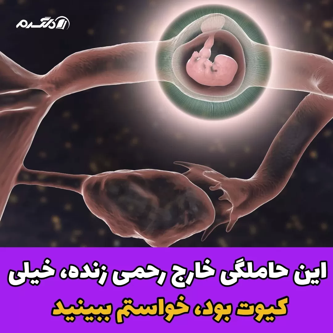بارداری/سقط جنین 