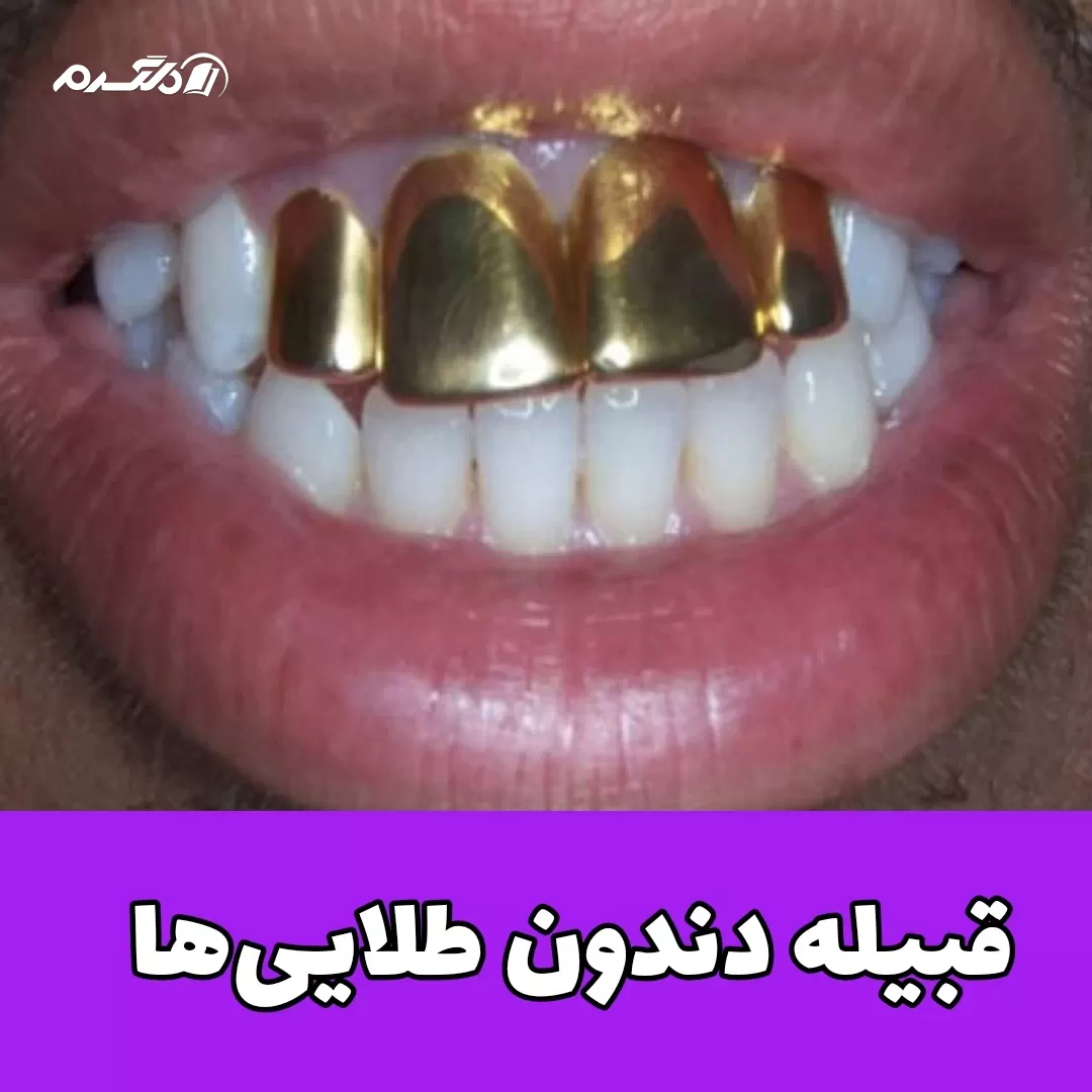 ماداگاسکار /قبیله عجیب