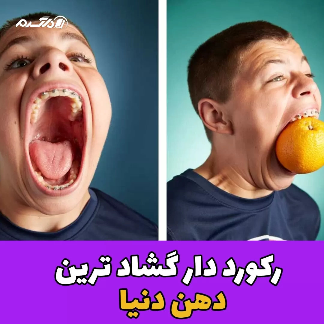 رکورد گینس/گشادترین دهان دنیا