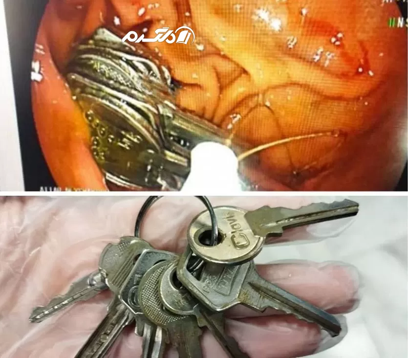 خوردن دسته کلید هفت‌تایی