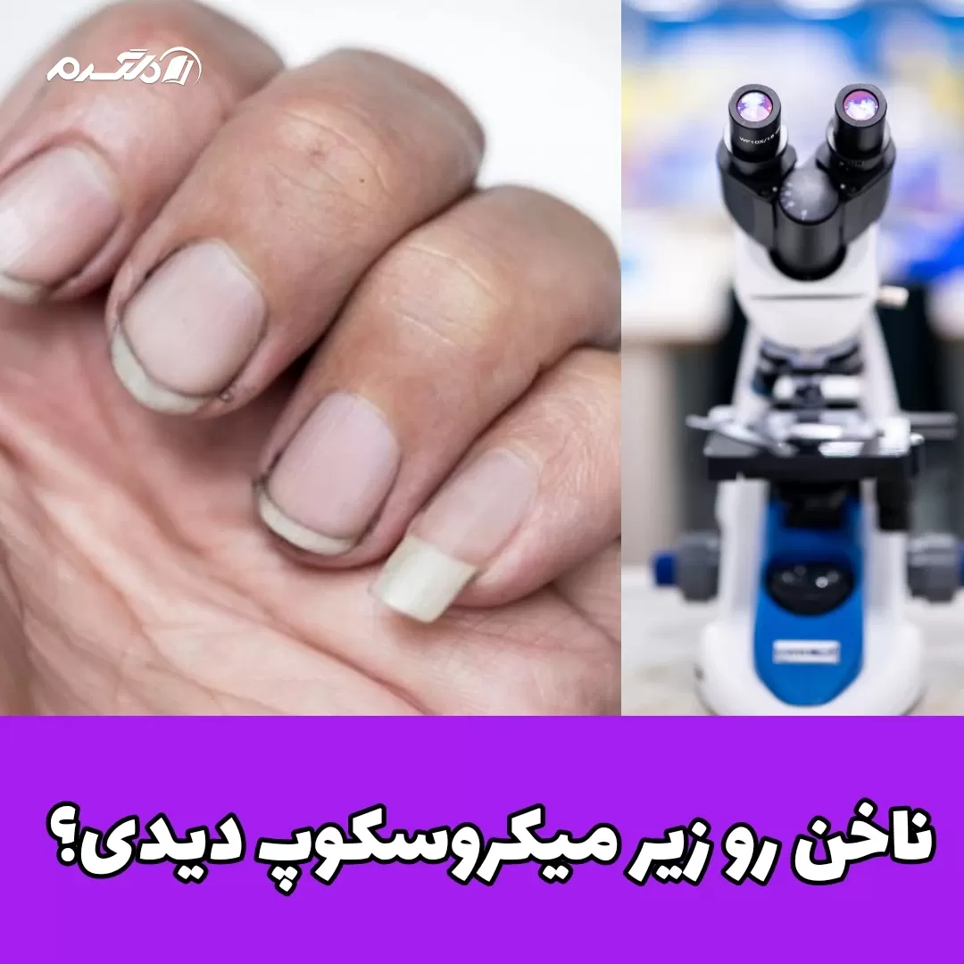 ناخن رو زیر میکروسکوپ دیدی