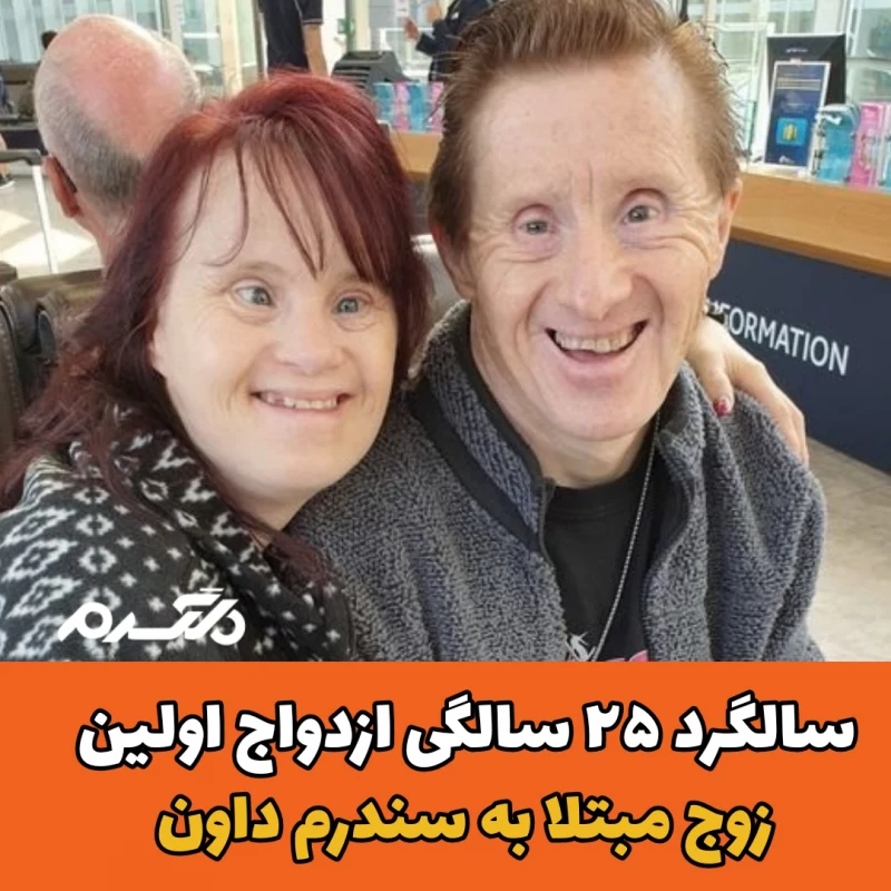 سالگرد ازدواج اولین زوج مبتلا به سندرم داون