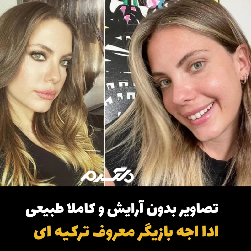 ادا اجه/بازیگر زن ترکیه ای