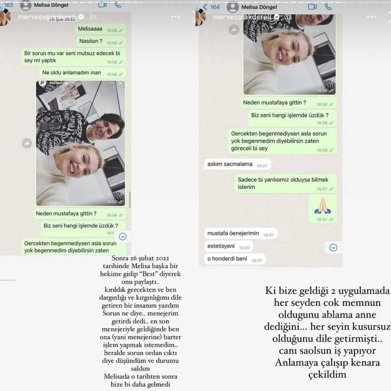 شوک چهره قبل از عمل زیبایی ملیسا دونگل بازیگر ۲۳ ساله ترکیه ای
