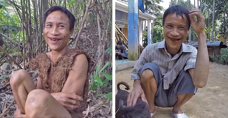 تارزان واقعی که ۴۱ سال در جنگل زندگی کرده است