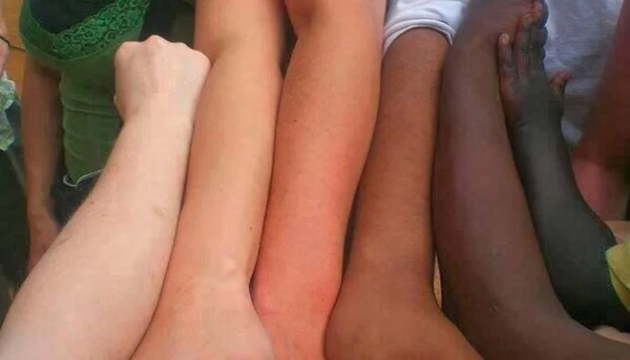 چرا نژادهای مختلف، رنگ پوست متفاوتی دارند؟