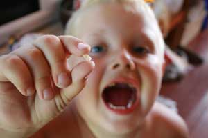 نکاتی در مورد صدمات دندانها در کودکان