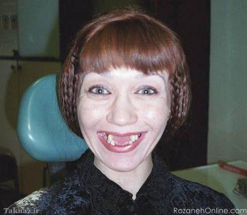 عکس دختر زشت با مقنعه