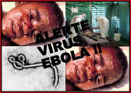 چراجهان در برابر ابولا منفعل است؟