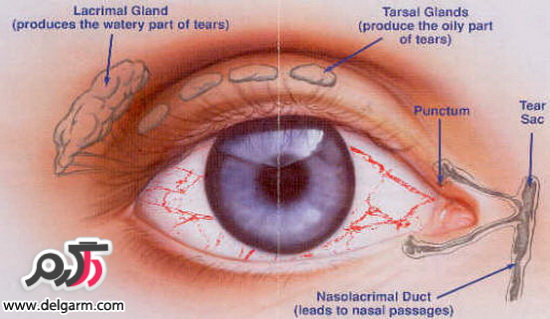 خشکی چشم و خشکی چشم چیست و جلوگیری از خشکی چشم