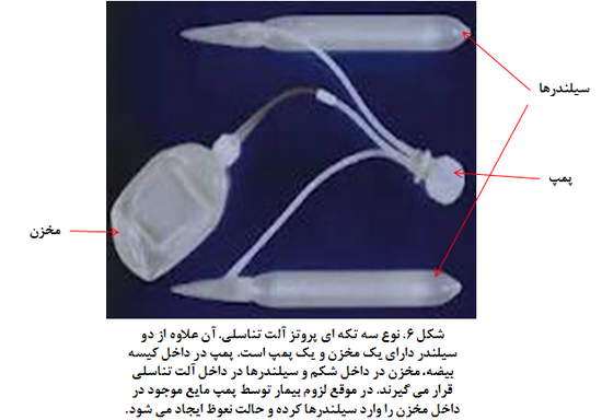 از دست دادن نعوظ و علل از دست دادن نعوظ و درمان از دست دادن نعوظ