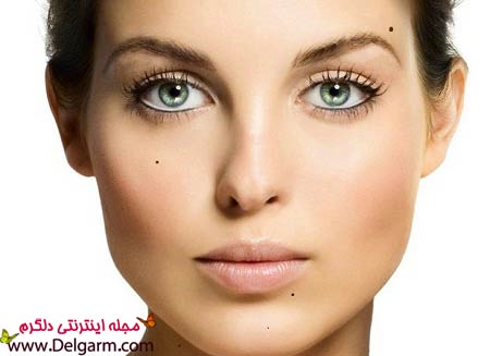 بهترين راه حذف خال ها بهترين راه حذف خال ها