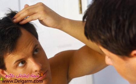 ریزش مو و چند علت اصلی ریزش موی سر