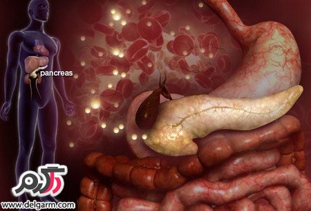 آشنایی با بیماری دیابت نوع یک