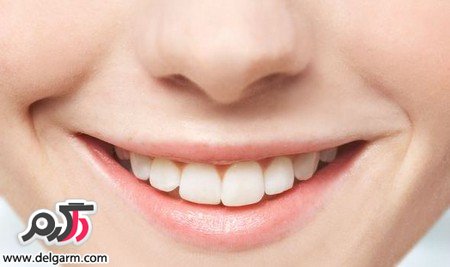 درمان پوسیدگی دندان با مواد غذایی مفید