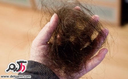 میزان طبیعی ریزش موی روزانه