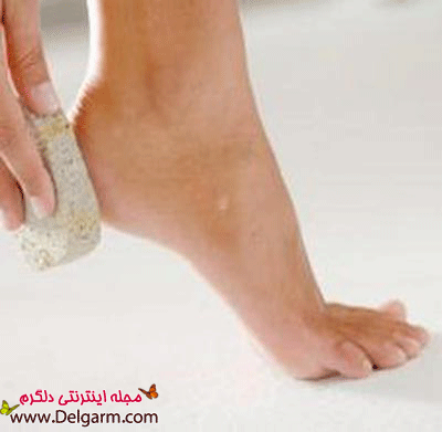 ترک پا ترک پا