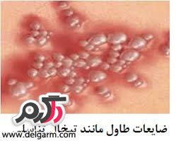 اهمیت تمیز بودن واژن در زنان 