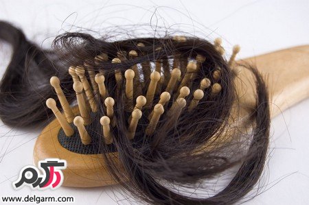 با این روش های سنتی از ریزش موهای خود جلوگیری کنید!!