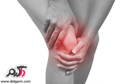 با این علائم بدانید که زانوهایتان بیمار است!!
