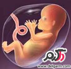بارداری، نوزاد، سن بالای حاملگی