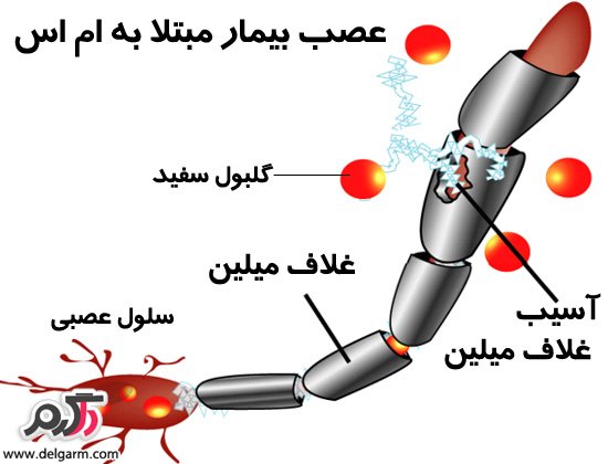 ام اس