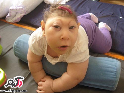 بچه های ناقص الخلقه