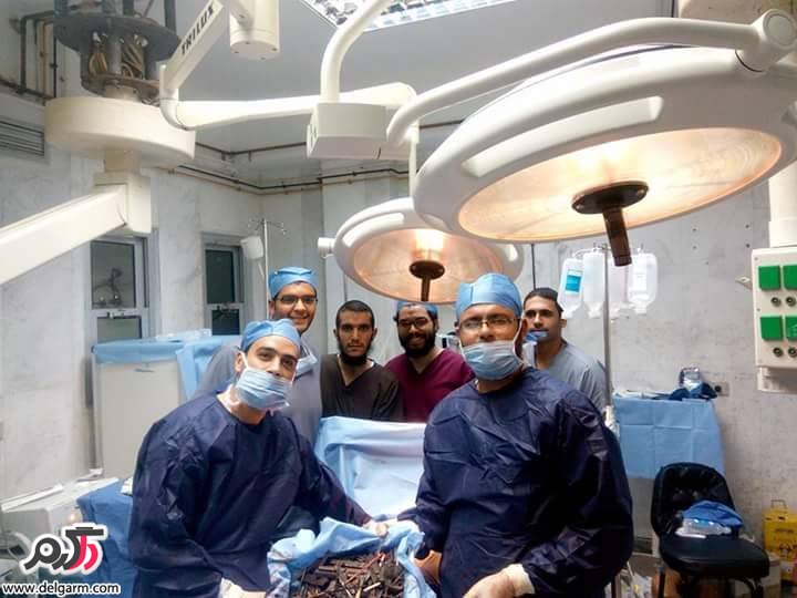کشف اشیاء عجیب در معده زن مصری