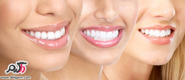 درمان آبسه دندان