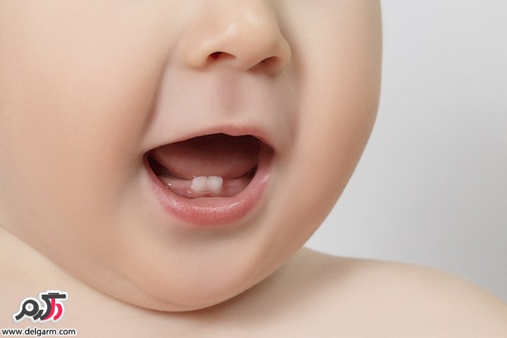 چرا برخی از نوزادان موقع تولد دندان دارند؟