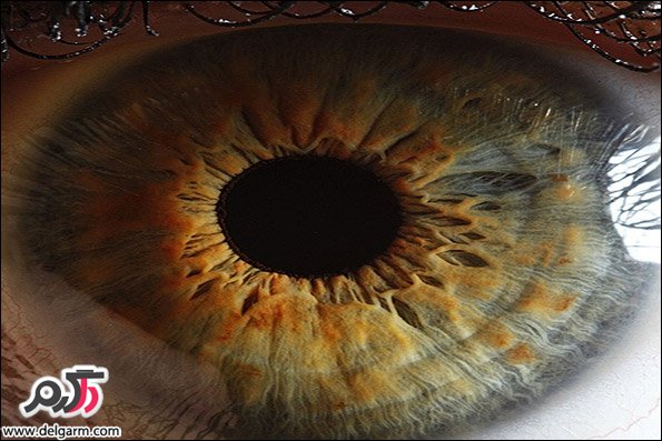 مضرات عمل چشم رنگی