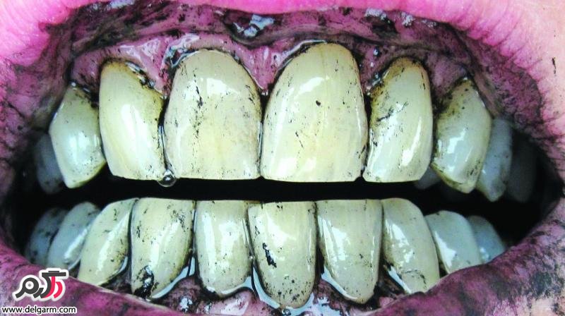 خمیر دندان زغال