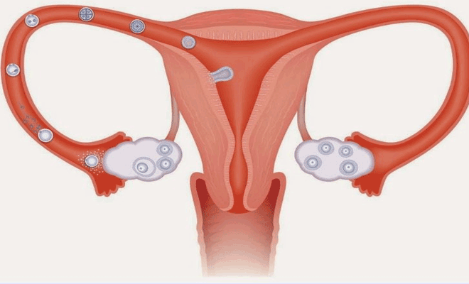 اندازه ی فولیکول وتاثیر ان در بارداری