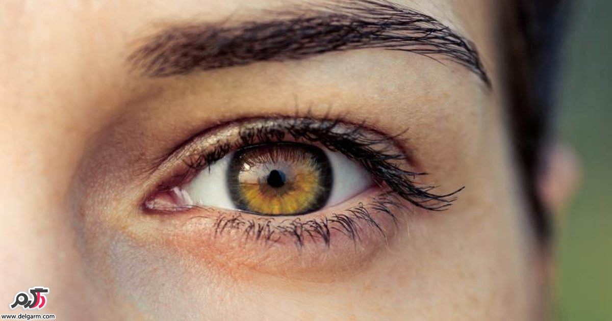  درمان گیاهی غده های چربی زیر پوست چشم