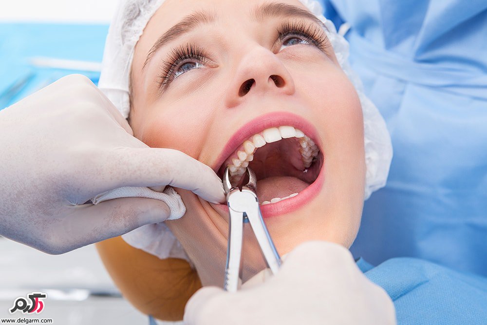 عوارض عفونت دندان