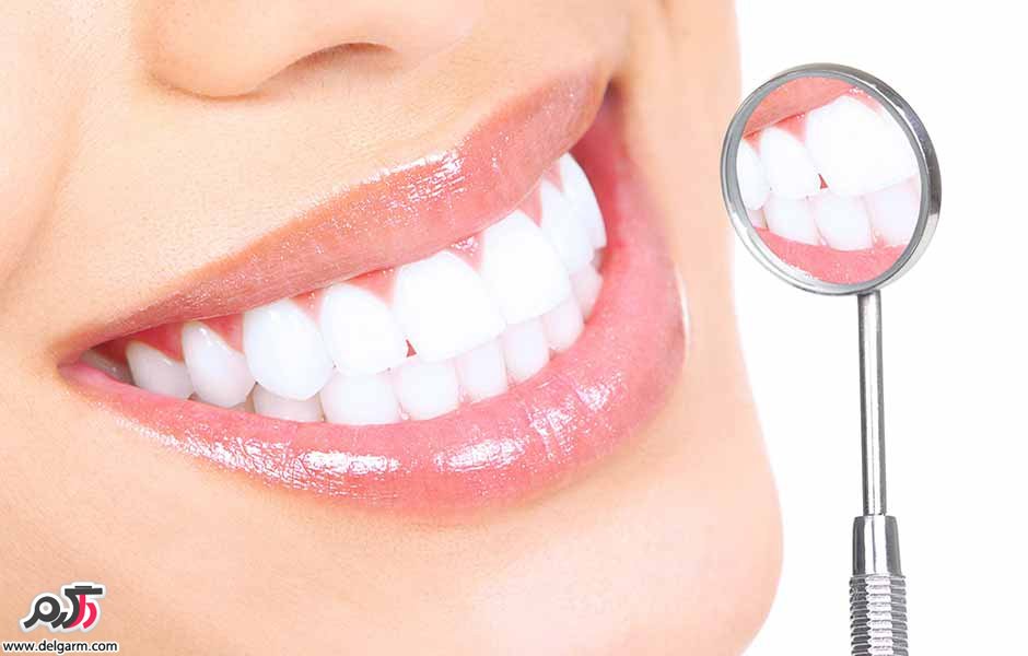  مینای دندان چیست؟ ترمیم و تقویت آن