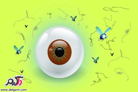درمان طبیعی برای مگس پران چشم