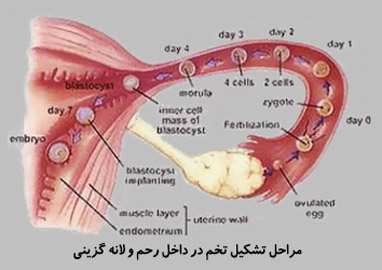 لانه گزینی چیست