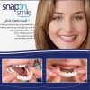 قیمت Snap On Smile